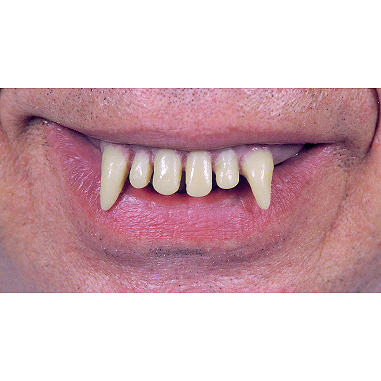 Glow in the Dark Ghoul Teeth for Halloween Scares and Costume Parties