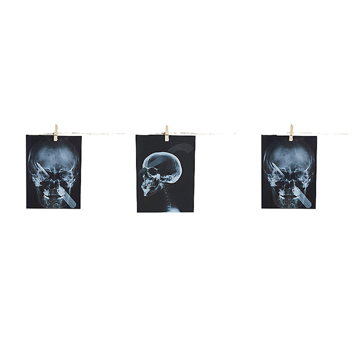 Torture X-Ray Garland, 63"