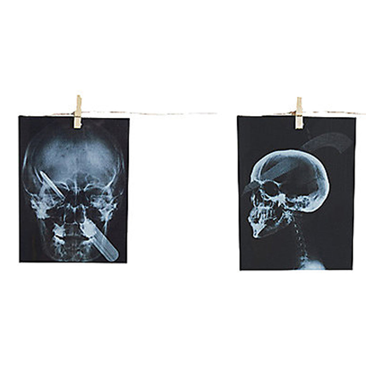 Torture X-Ray Garland, 63"