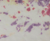 Cotton Thermal Knit Tie Dye Fabric