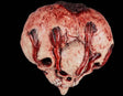 Horror Skull Heart - Latex Prop