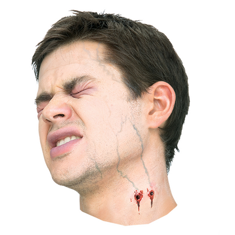 Vampire Bite Prosthetic
