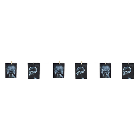 GARLAND-TORTURE X-RAY 63 IN.