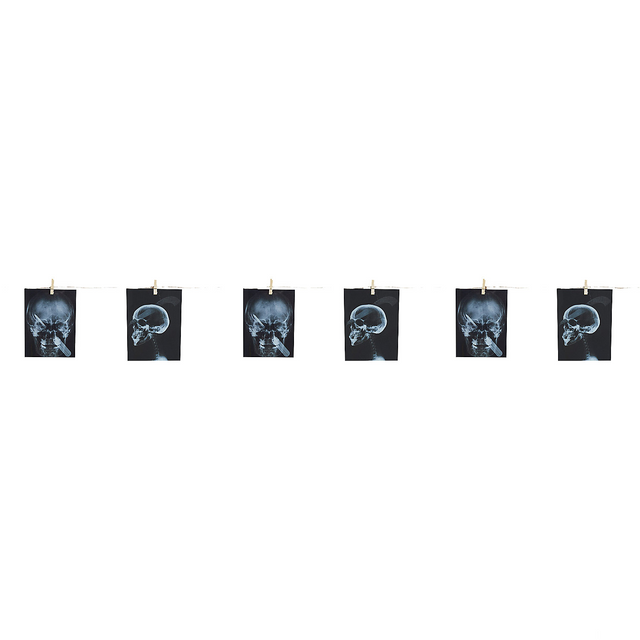 GARLAND-TORTURE X-RAY 63 IN.