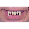Ghoul Teeth