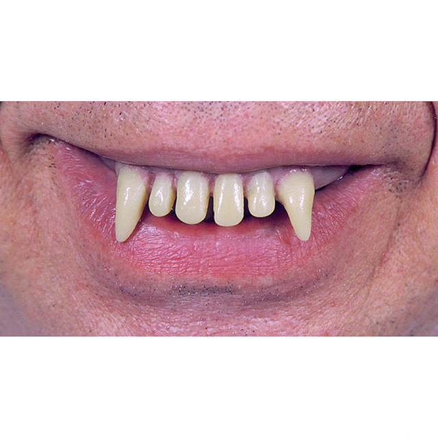 Ghoul Teeth
