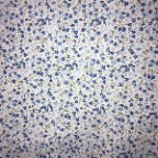 Mini Daisy Floral Poly Cotton Fabric - Fuchsia, Purple, Red, Royal Blue Daisy Print, 58/60" Width