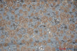 Luxury Mesh Embroidery Polyester Fabric - Embroidered Floral Mesh, 54" Width, Champagne (1 Yard)